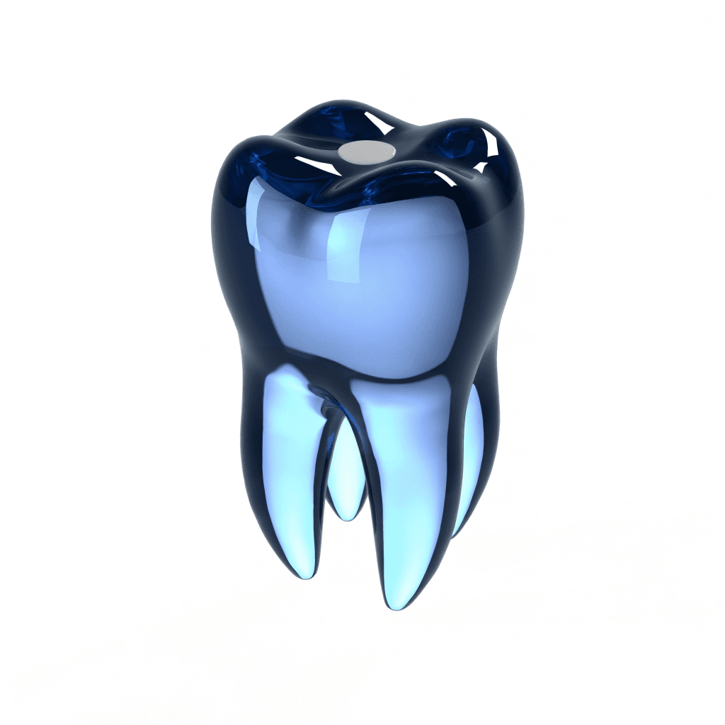 Dental Filling at Dent Health, Banjara Hills Dental Filling at Dent Health, Banjara Hills, Hyderabad