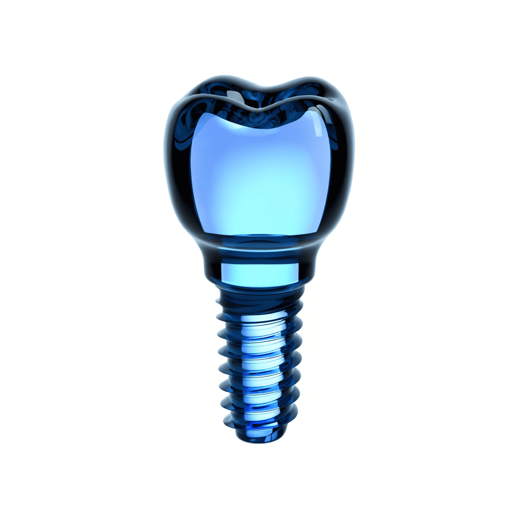 Dental Implants at Dent Health, Banjara Hills Dental Implants at Dent Health, Banjara Hills, Hyderabad