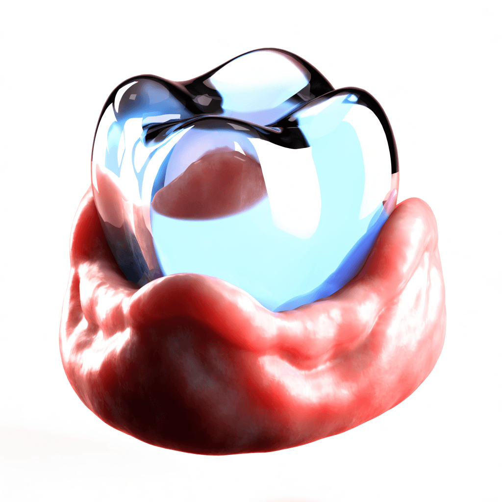 Gum Disease at Dent Health, Banjara Hills Gum Disease at Dent Health, Banjara Hills, Hyderabad